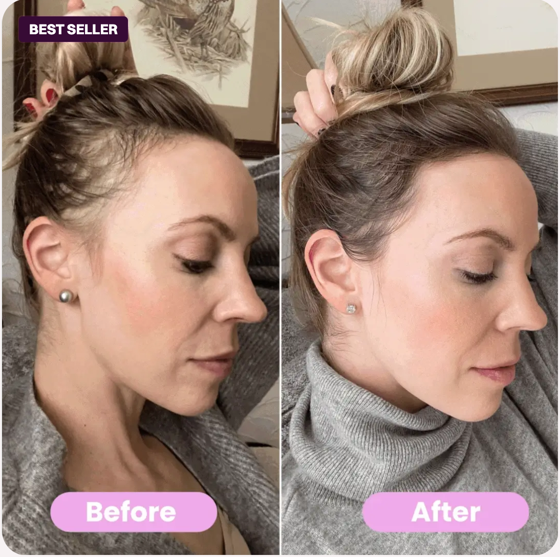 LumiGlow Scalp Therapy Comb