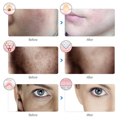 7 Colors LED Photon Beauty Mask - GlowLiftEssentials.shop